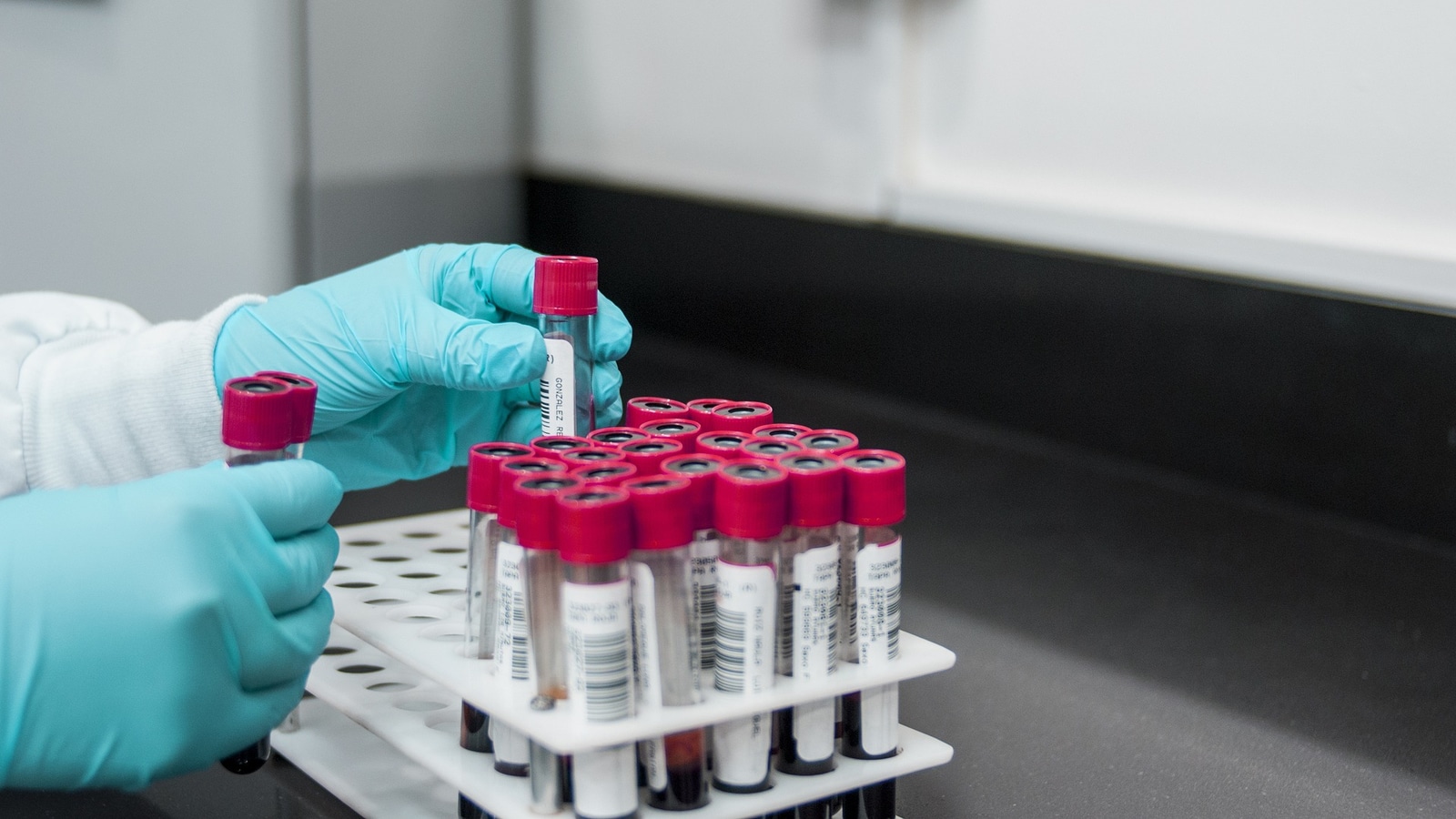 £14m fundraise approved as Cheshire biotech announces positive preclinical data for potential chronic kidney disease treatment - Vimarsana News