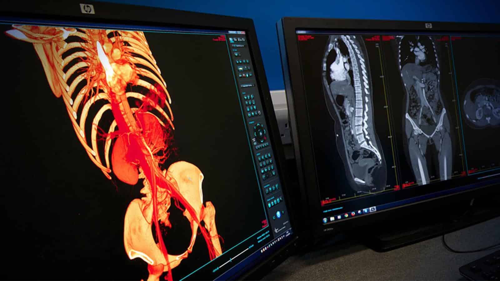 Digital Autopsy UK signs partnership with Bolton Council - Vimarsana News